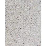 Exquisite Rugs Mosaic Leather Silver 405996X136 9ft.6in.X13ft.6in. Rect. Rug
